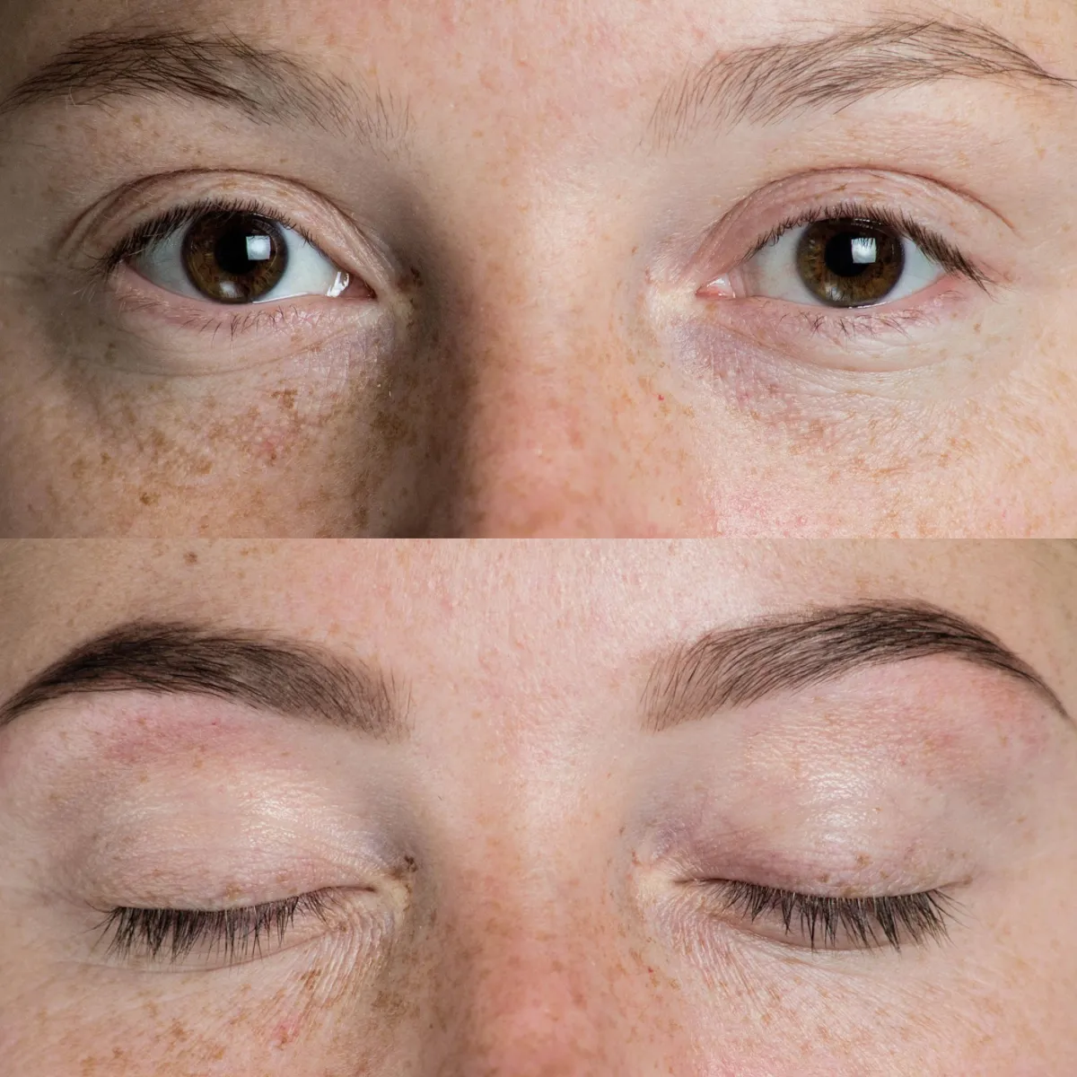 Före och efter Microblading hos Ekstrandskliniken, precis brynform