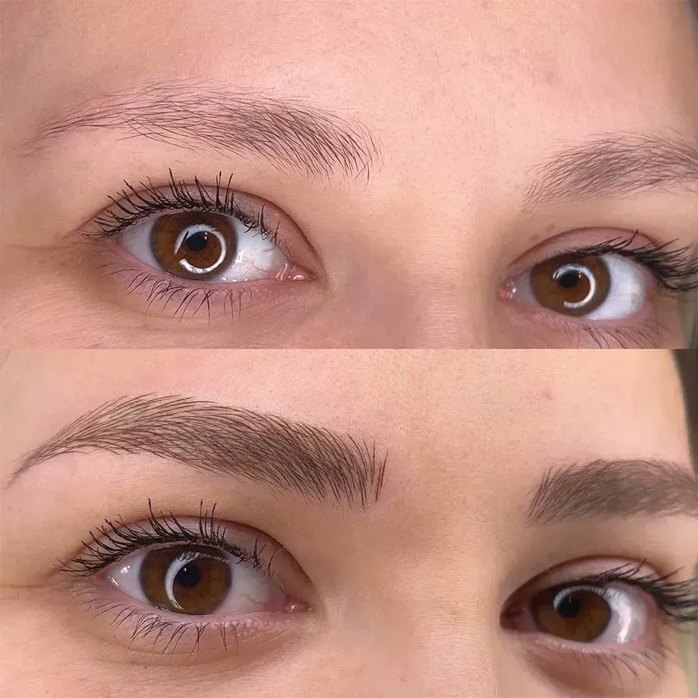 Före och efter Microblading hos Ekstrandskliniken, kraftfulla naturliga bryn